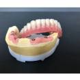 Dantų technikas bendradarbiautų su odontologu